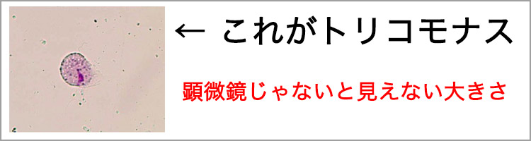 トリコモナスとは