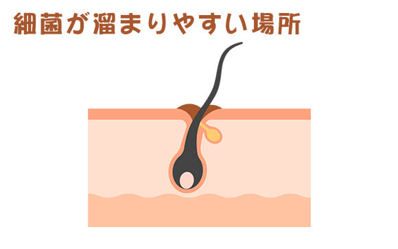 アンダーヘアはどうすればいいの？