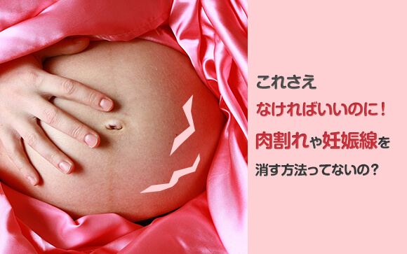 これさえなければいいのに！肉割れや妊娠線を消す方法ってないの？