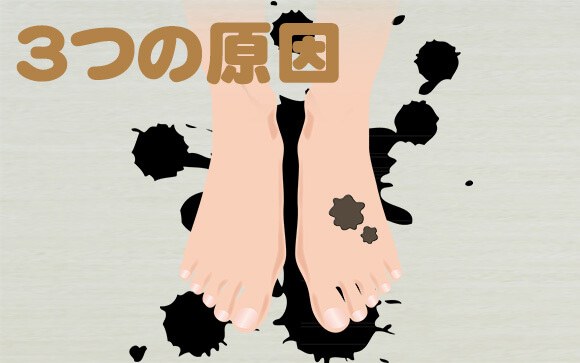 一般的に足が臭くなる原因だと思われていること