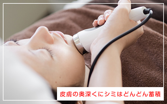 シミも日焼けも消えずに蓄積する