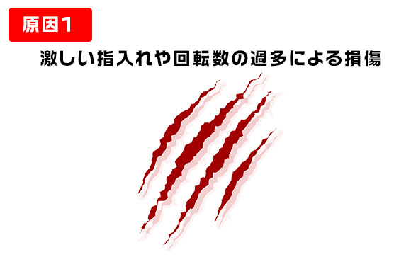 膣に傷がついた