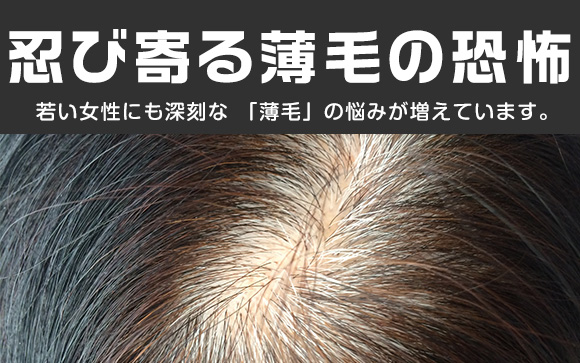薄毛は夏に進行する