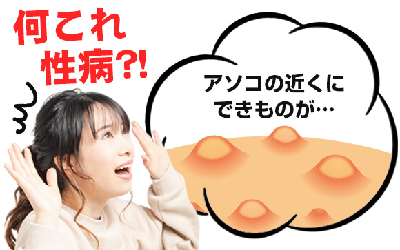 何これ、性病?!できものが…