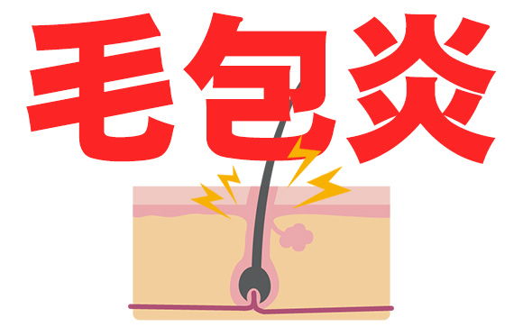 せつとは