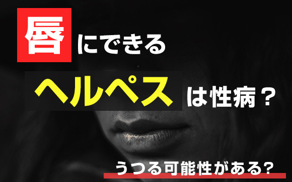 唇にできるヘルペスは性病？うつる可能性があるの？