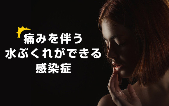 ヘルペスとは