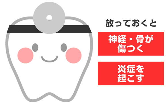 歯が折れたり欠けた場合