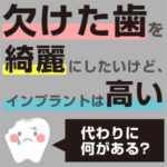 欠けた歯を綺麗にしたいけどインプラントは高い！代わりに何がある？