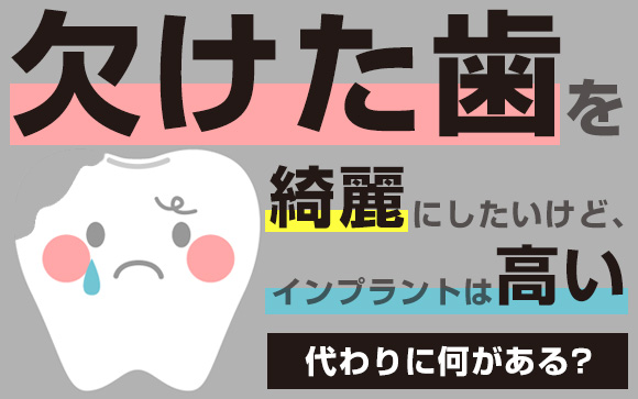 欠けた歯を綺麗にしたいけどインプラントは高い！代わりに何がある？