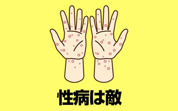 風俗嬢の敵、性病
