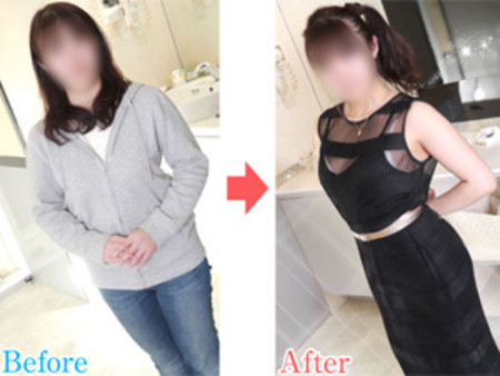 美的ストーリーの「変身ビフォアーアフター」